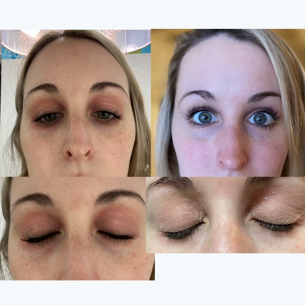 Eyes before and after using Marin